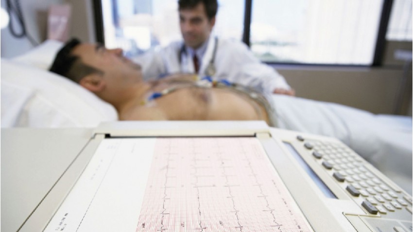 Electrocardiograma