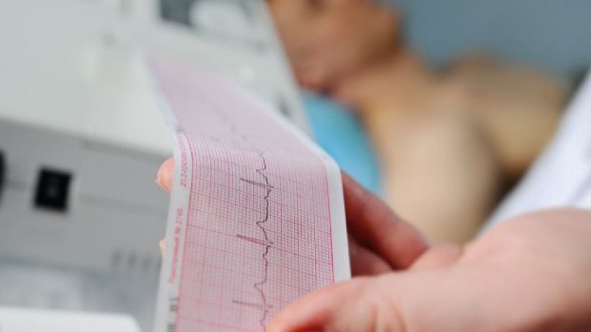 Holter imagen