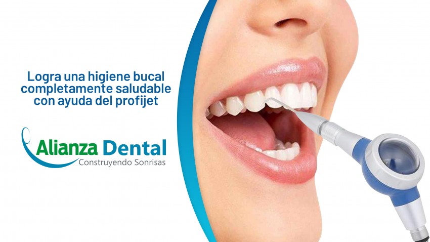 Limpieza con Profijet